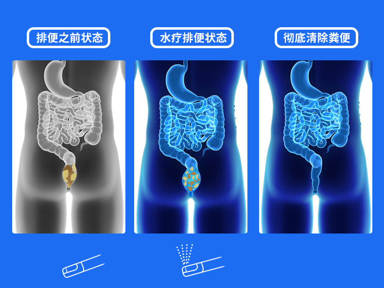 智能马桶双水路带灌肠通便方形智能一体机落地安装